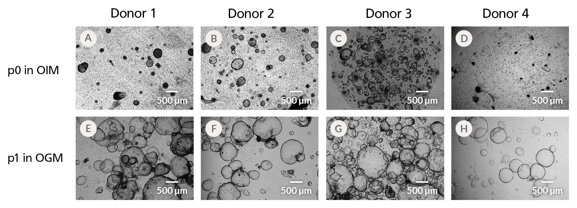 HepatiCult™ Organoid Initiation Medium (Human) Supports Robust Organoid Establishment