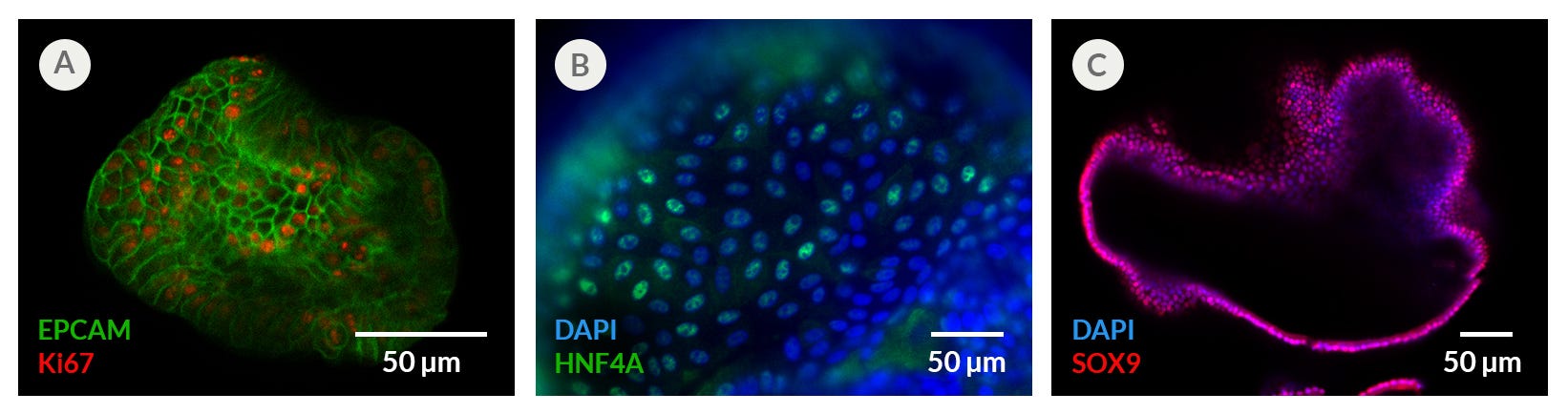 Proliferating Hepatic Organoids Display Characteristics of Hepatic Progenitors