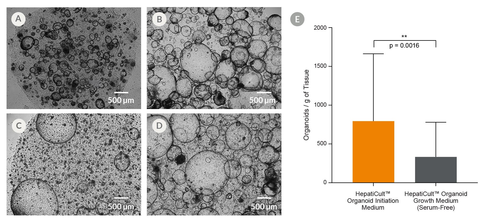 HepatiCult™ Organoid Kit (Human) Provides Efficient Organoid Initiation From Human Liver Tissue