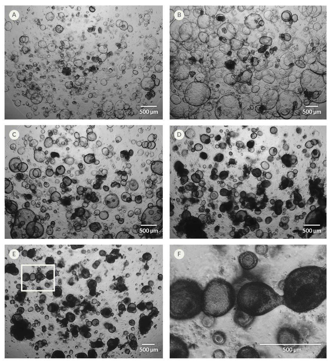 Organoid Differentiation Induces Changes in Organoid Morphology